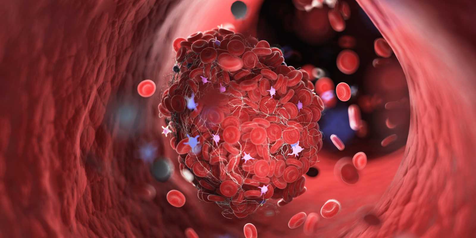 Newly FDA Approved Blood Thinning Medications